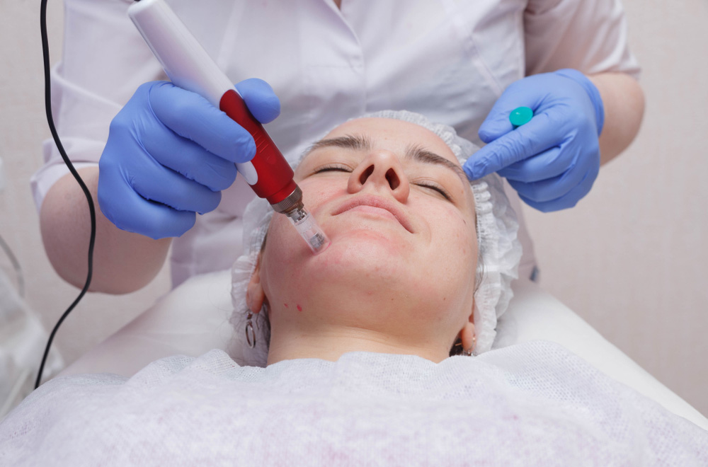 Platelet-Rich Plasma (PRP) therapy