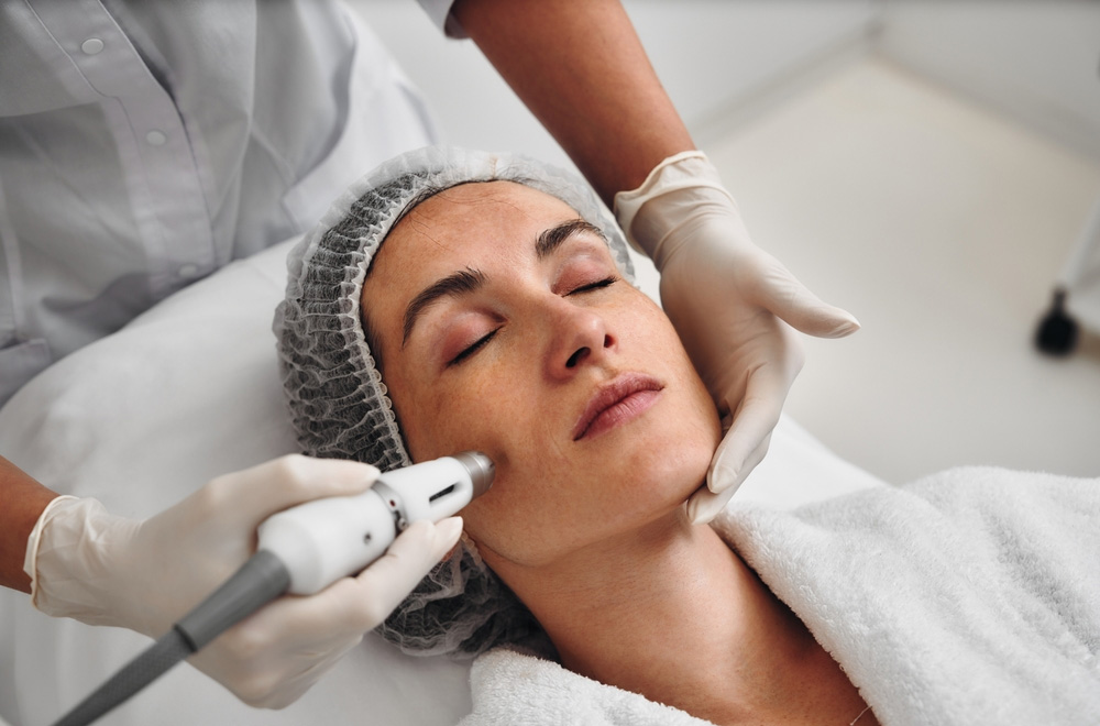 Acne Scar treatment at LARC