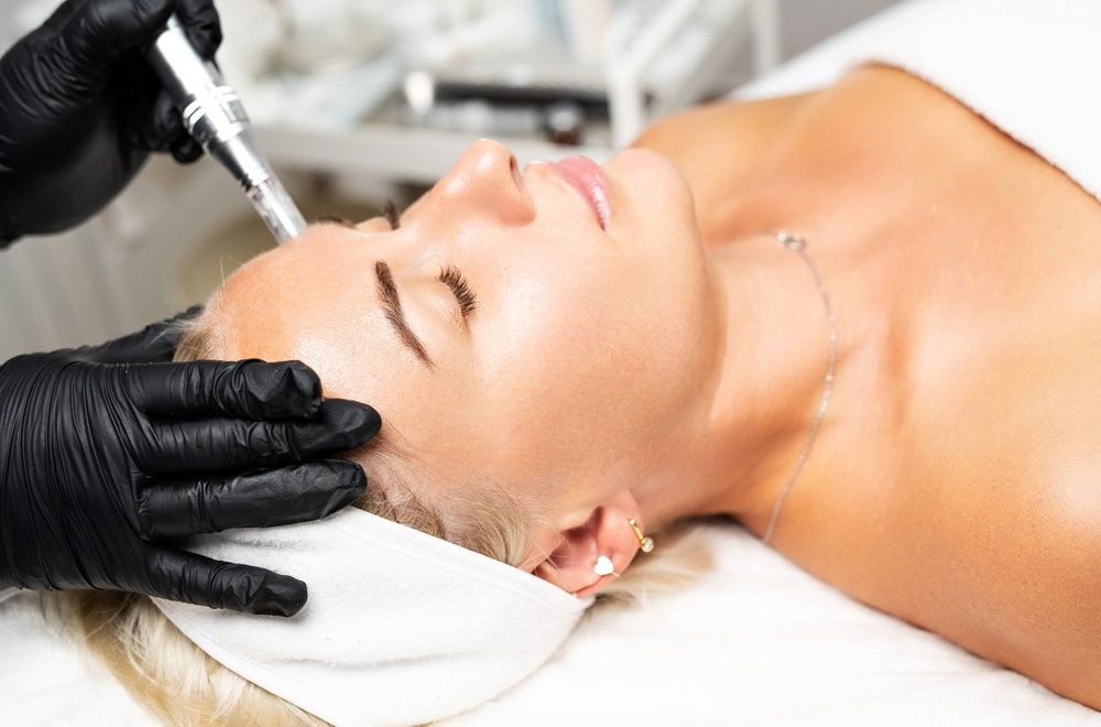 Microneedling with Radiofrequency