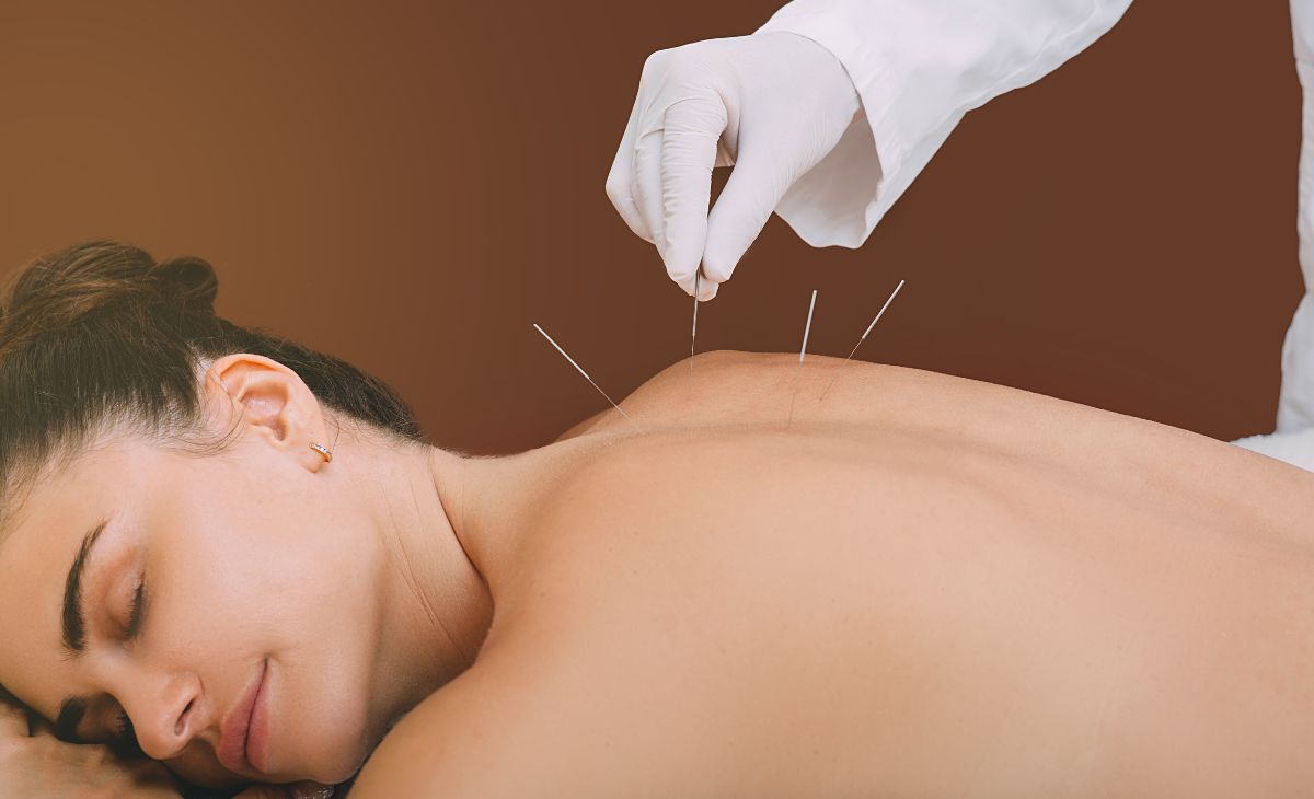 Acupuncture Treatment