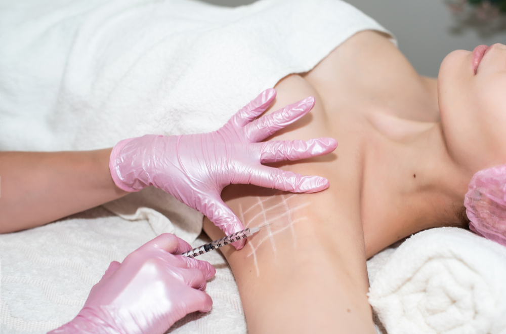 hyperhydrosis treatment with botox
