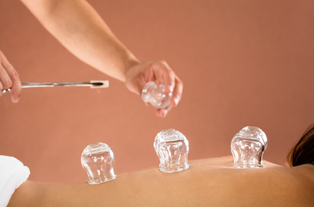 hijama cupping therapy benefits