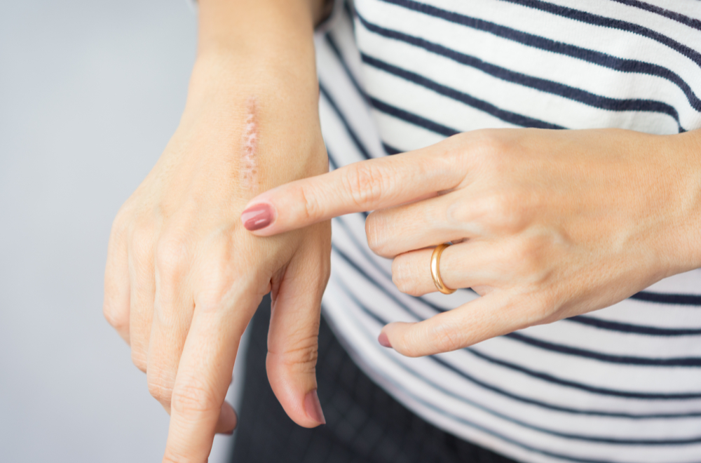 skin repair and healing treatment