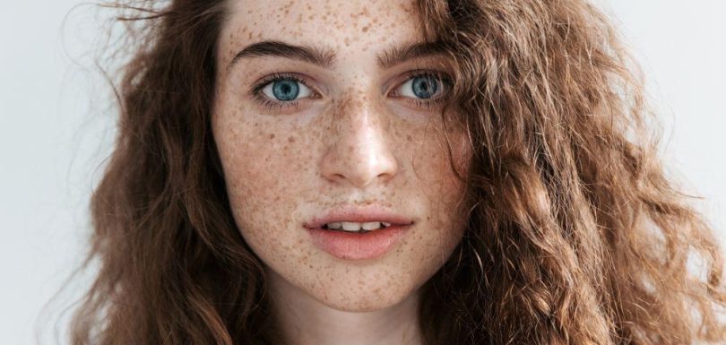 pigmentation treatment