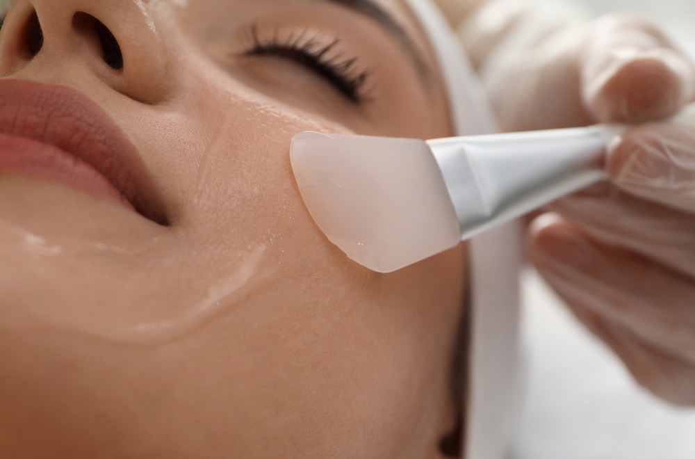 chemical peels for pigmentation