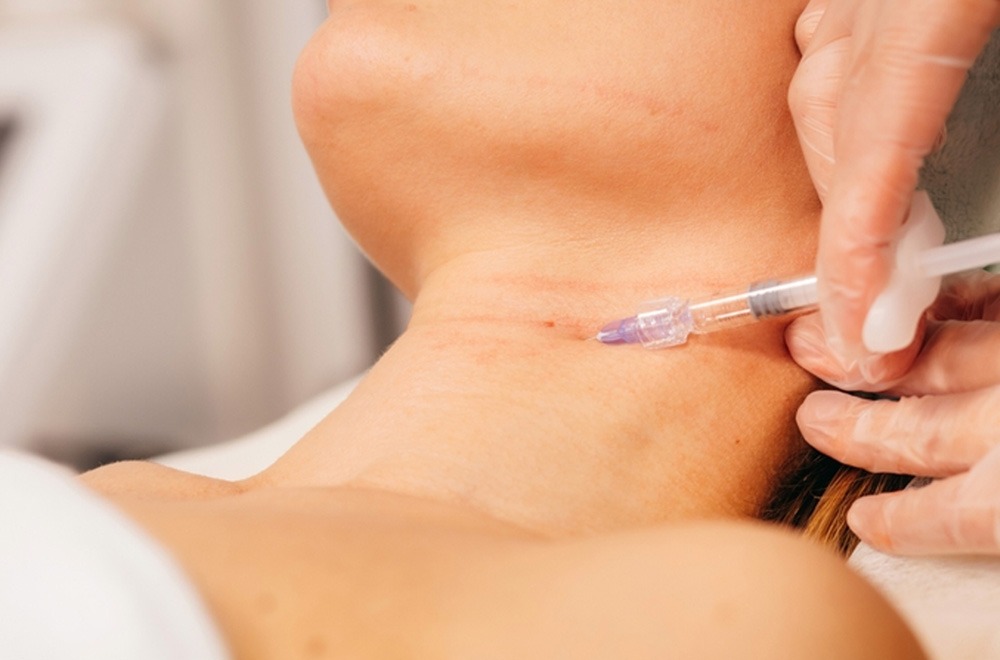 platysmal bands treatment