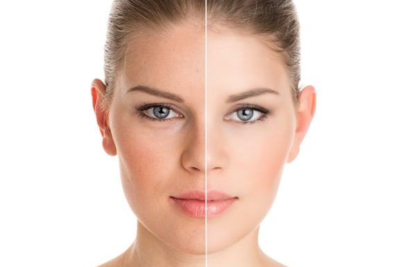 face rejuvenation treatment