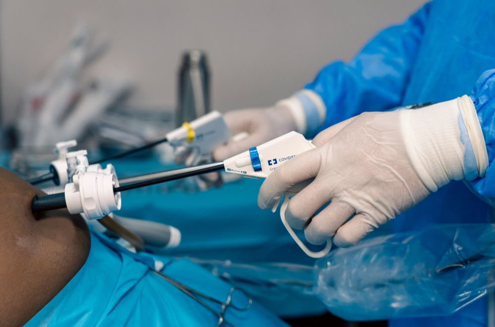 sleeve gastrectomy for surgical weight loss