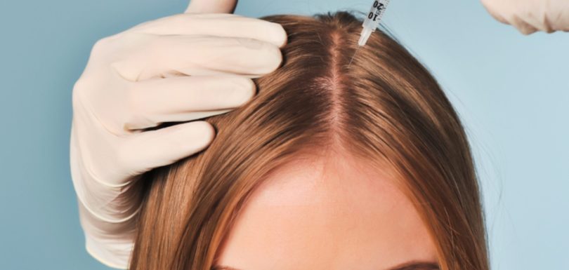 Regenera Stem Cell Hair Therapy