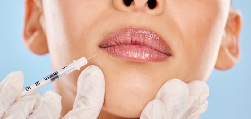 Restore Youthful Volume With Fillers
