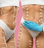 Cosmetic,Procedure,For,Body,Sculpting.,Gloved,Hands,Of,Doctors,Performing