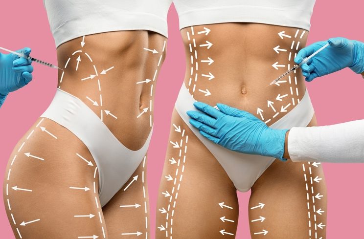 Cosmetic,Procedure,For,Body,Sculpting.,Gloved,Hands,Of,Doctors,Performing